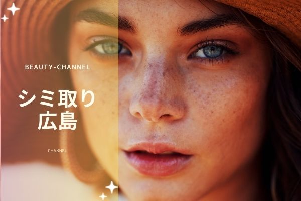 広島でシミ取りが人気のおすすめクリニック１０選 取り放題コース料金や口コミなど Beauty Channel ヘアケアクリニック