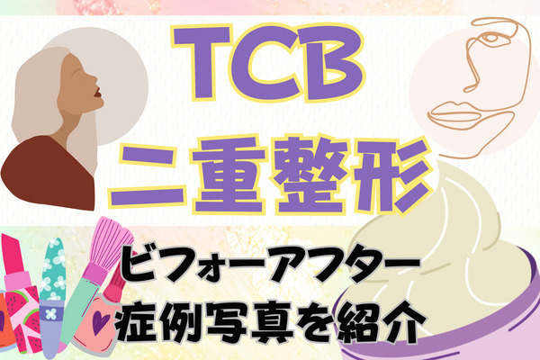 TCB東京中央美容外科の二重整形のビフォーアフター症例写真を紹介