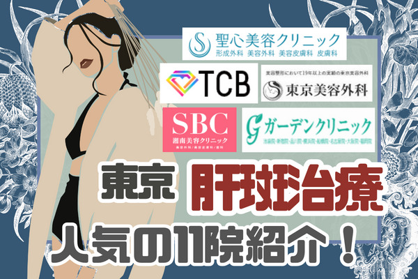 東京で肝斑治療が人気の11院｜名医の口コミや料金を紹介