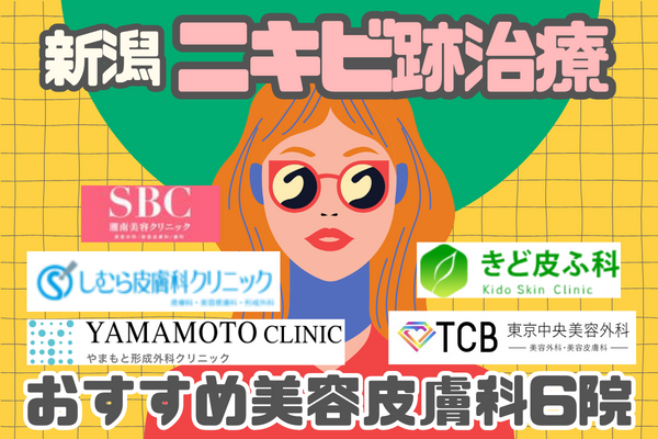 新潟市でニキビ跡治療が安い！おすすめ美容皮膚科6院