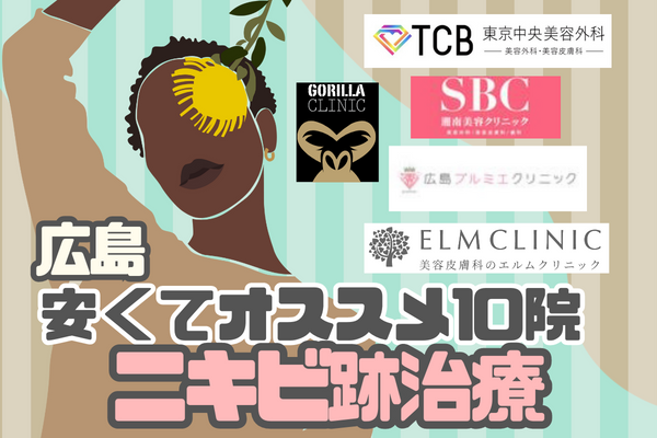 広島でニキビ跡治療が安いおすすめのクリニック・美容皮膚科10院！
