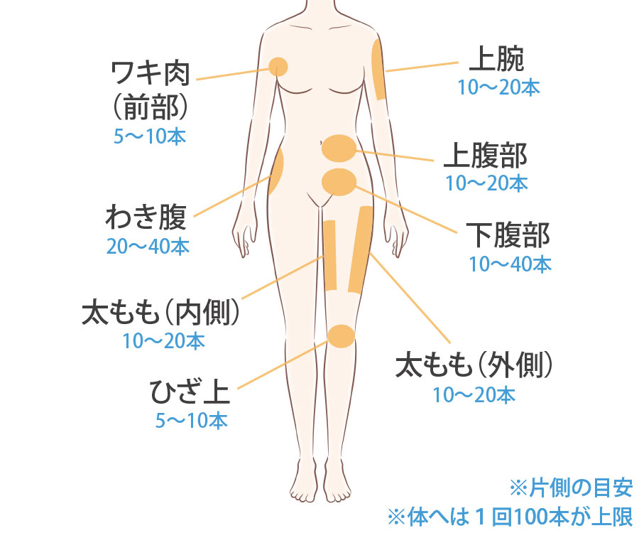 fatxcoreの体の施術部位と注入量の目安