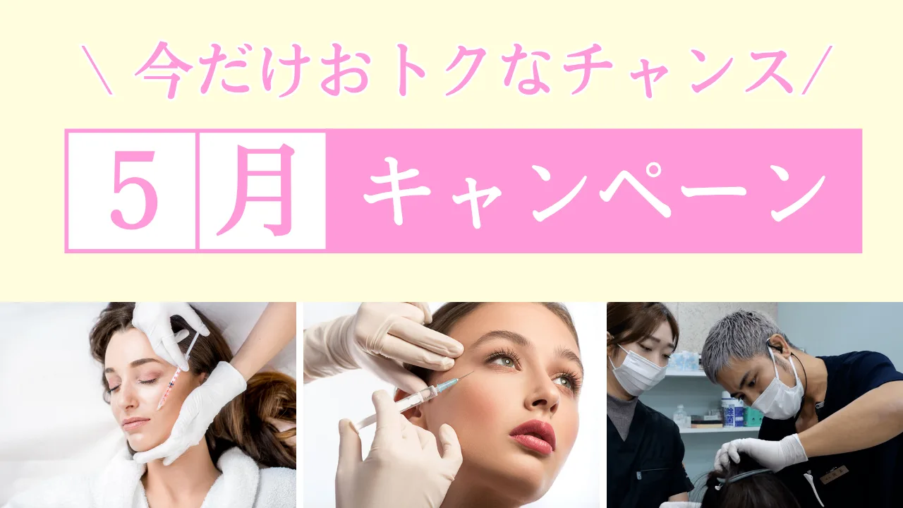 5月限定キャンペーン1