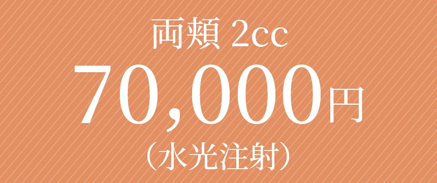 70000円