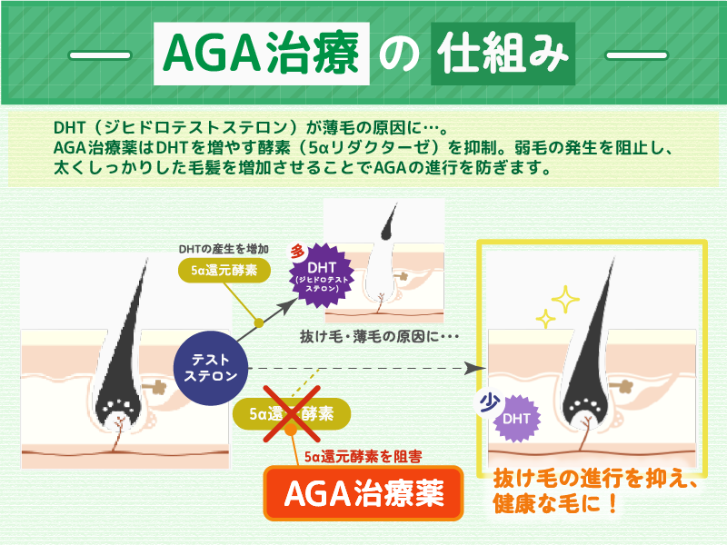 AGA治療_仕組み