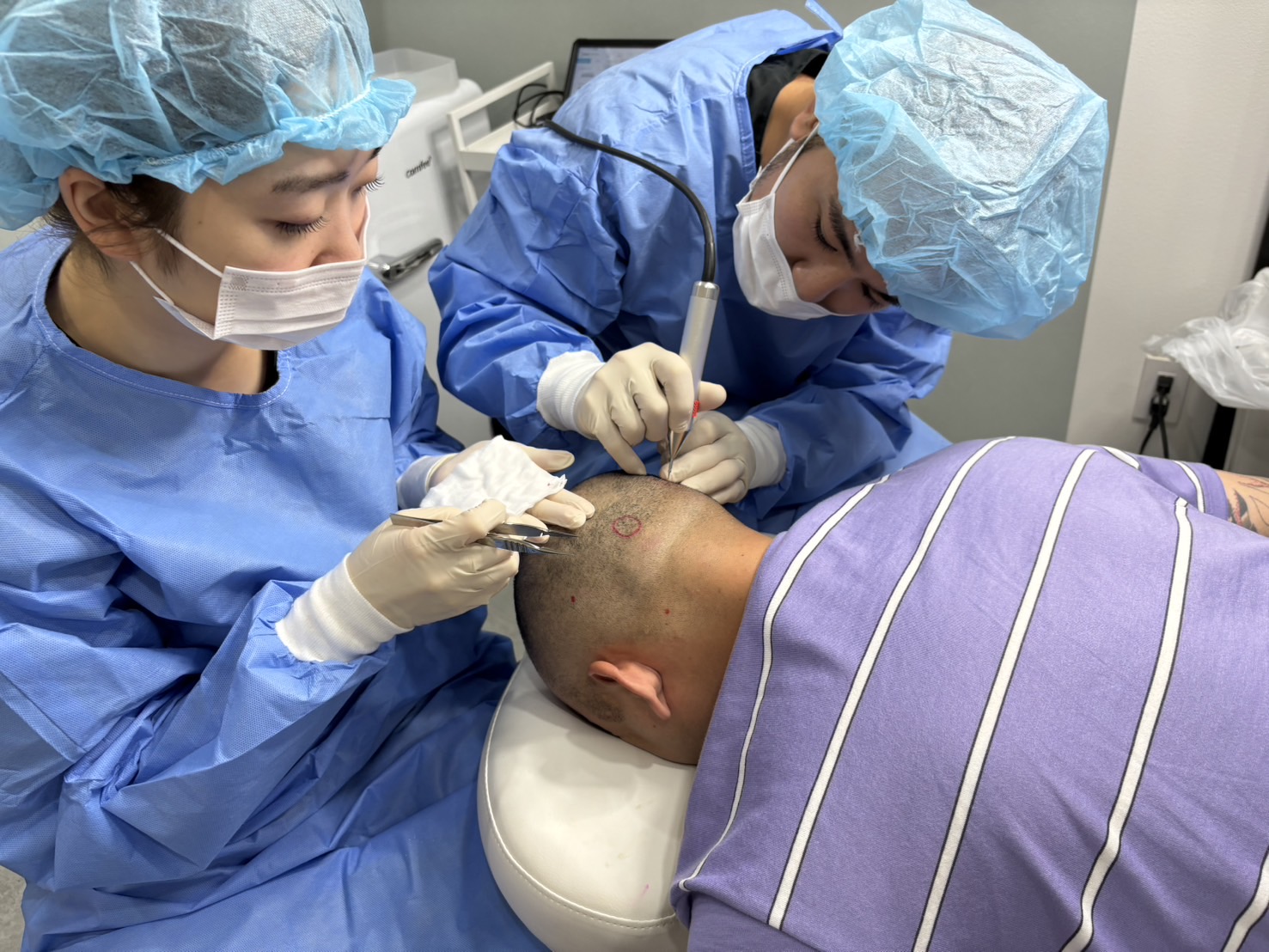 植毛（各部位メニュー）