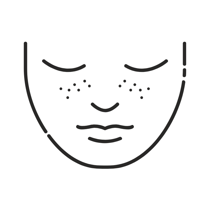 しみ・そばかす