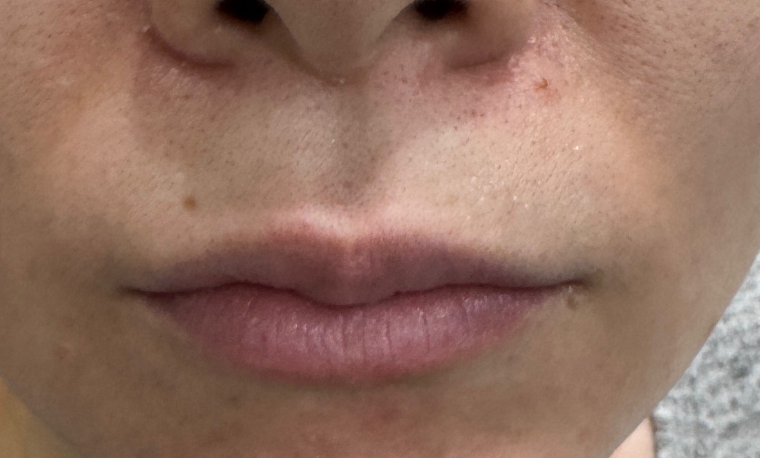 Before