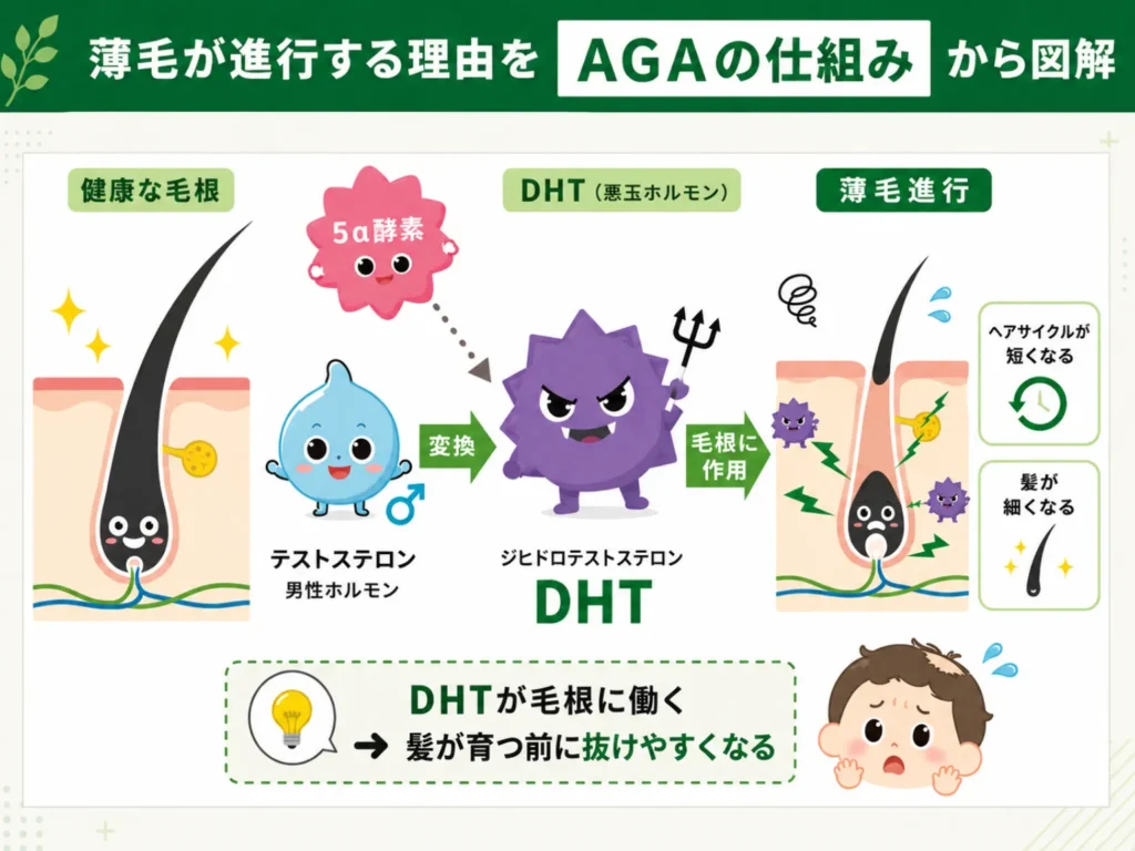 AGA治療_AGAとは？