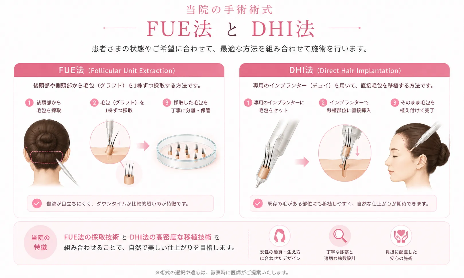FUE法によるグラフト採取とDHI法による移植の流れを示す模式図
