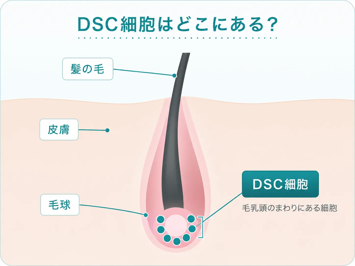 DSC細胞はどこにあるかを示す毛包の構造図。髪の毛、皮膚、毛球、DSC細胞の位置関係をわかりやすく示した図。
