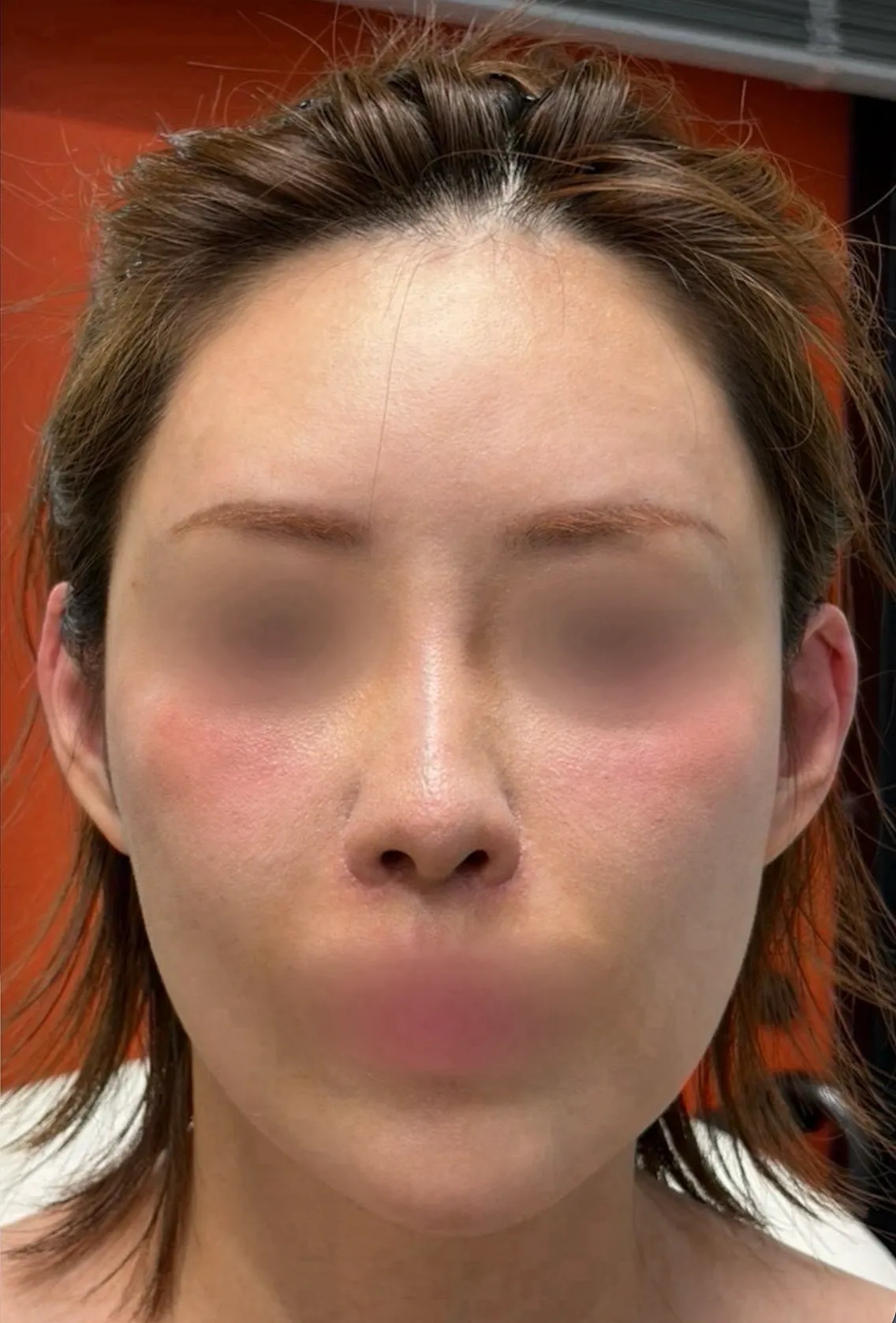 After