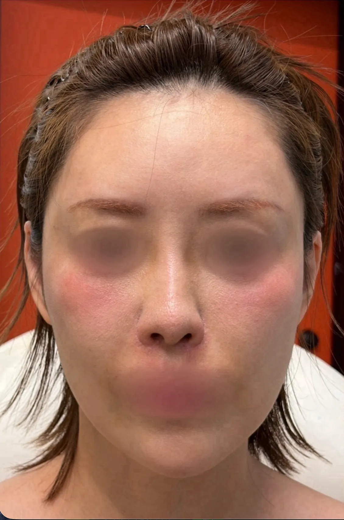 Before
