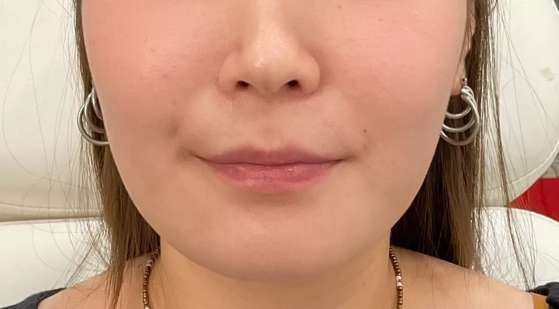 Before